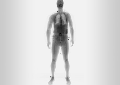 Full Body X-ray FBXscan