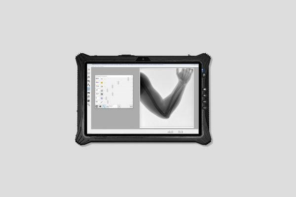 RescueXScan Portable X-ray